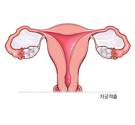 수술