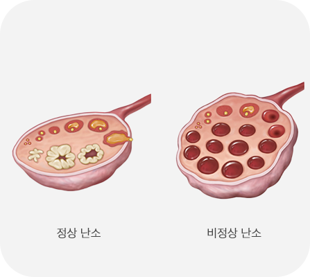 병력 청취
