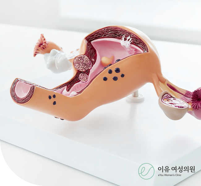 임신중절