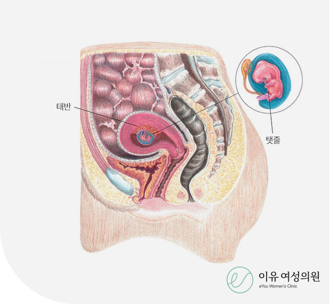 임신 초기 관리