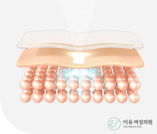 Vaginal rejuvenation